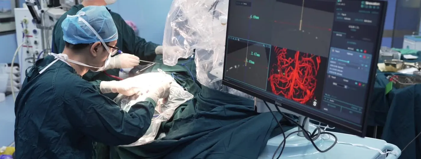 Two surgeons in green scrubs and surgical caps work over a draped patient beside a plastic-sheathed robotic arm, while a monitor at the right shows a stereotactic navigation view with a red three-dimensional reconstruction of brain vasculature and millimetre coordinates.