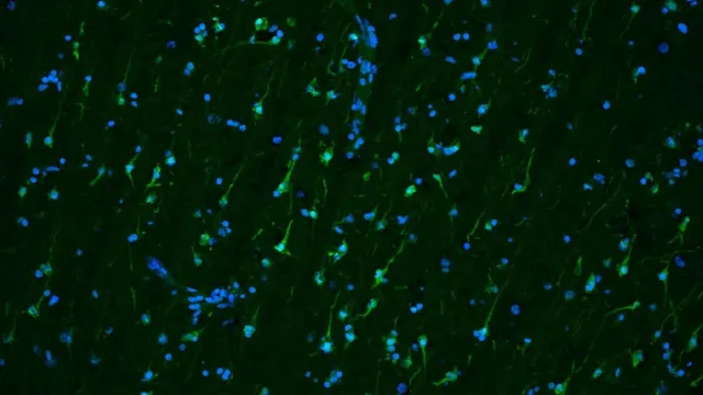 Fluorescence microscopy of brain tissue: green neuron bodies and trailing processes scattered across a dark field, with blue cell nuclei throughout.