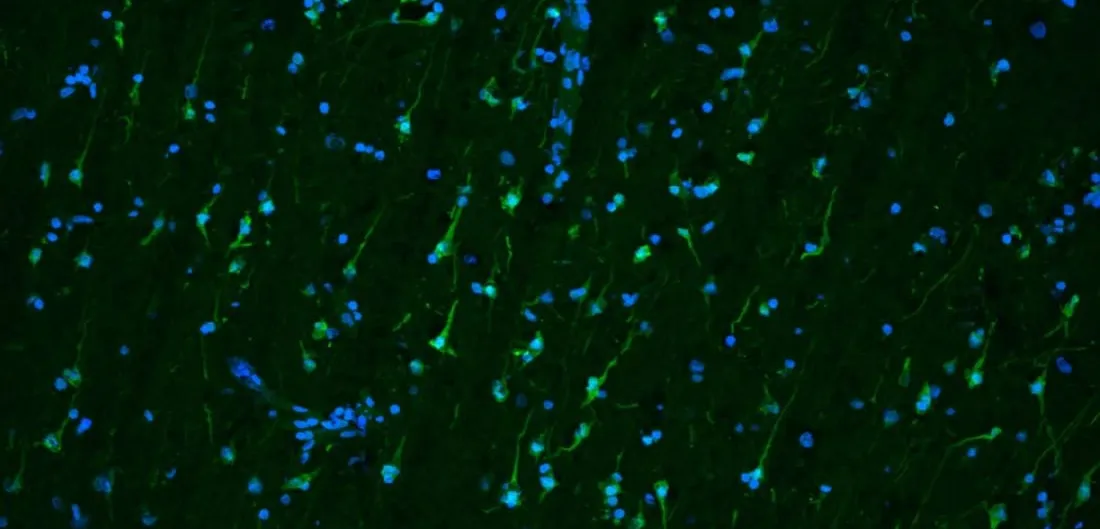 Fluorescence microscopy of brain tissue: green neuron bodies and trailing processes scattered across a dark field, with blue cell nuclei throughout.