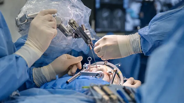 Close-up photograph of gloved surgical hands guiding a fine injection cannula mounted on a stereotactic frame toward a patient's exposed scalp during a neurosurgical cell-therapy procedure.