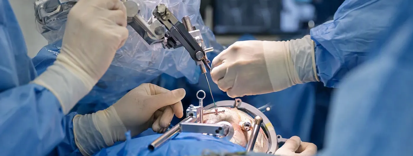 Close-up photograph of gloved surgical hands guiding a fine injection cannula mounted on a stereotactic frame toward a patient's exposed scalp during a neurosurgical cell-therapy procedure.